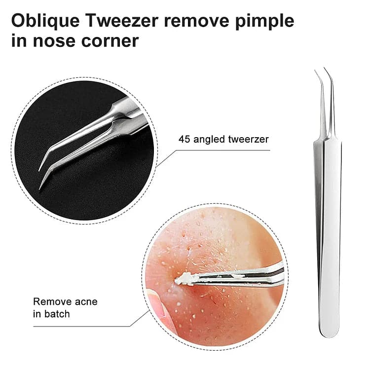 Blackhead Removal Tweezers