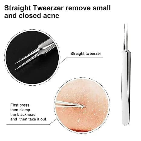 Blackhead Removal Tweezers