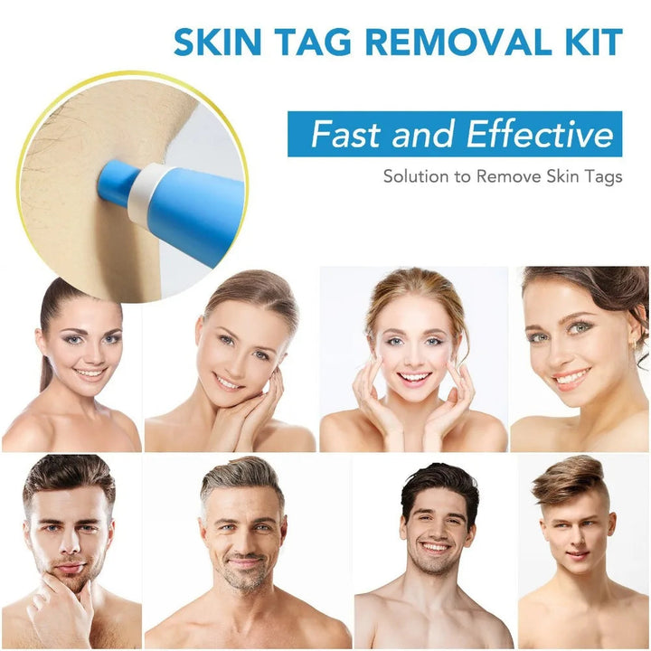 Auto Skin Tag Removal Kit